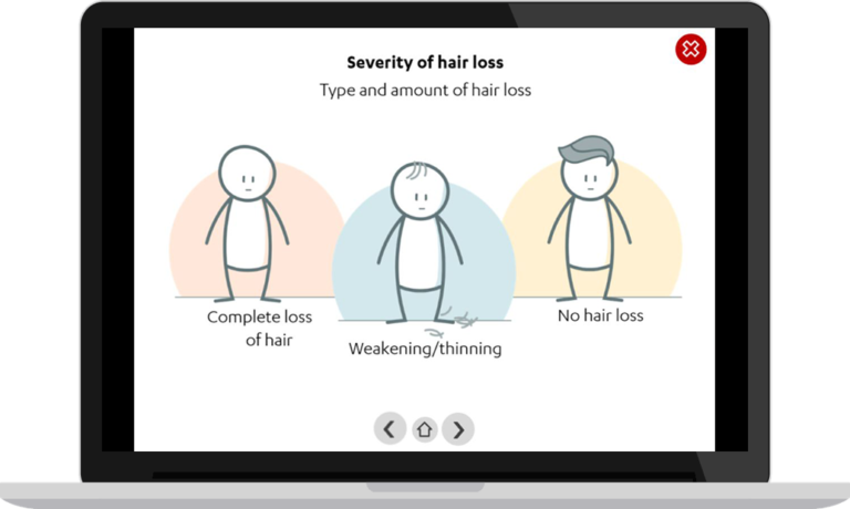 PREFER lung cancer_attribute severity of hair loss